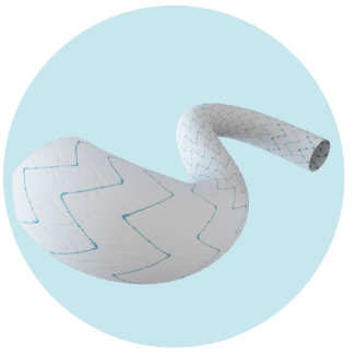 Minos™ - EVAR  helical stent