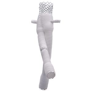 Fenestrated Altura™ - FEVAR Ultra-Low Profile FEVAR Device